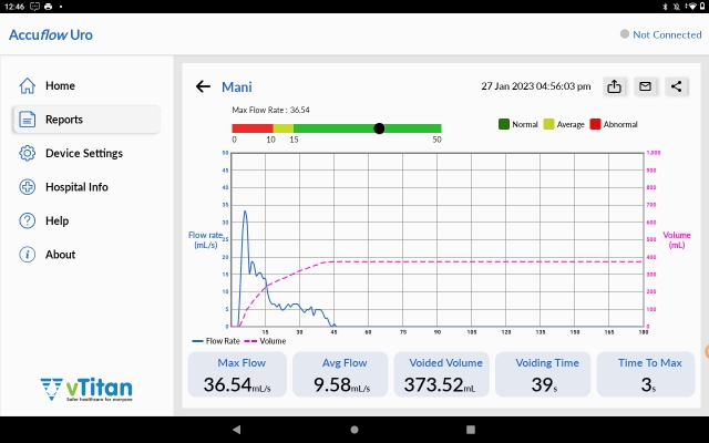 Uroflowmetry Test Comprehensive Reports by using Accuflow Uro