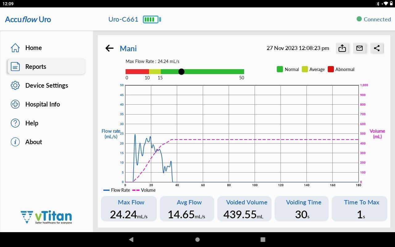 Uroflowmetry Test Comprehensive Reports from Accuflow Uro application