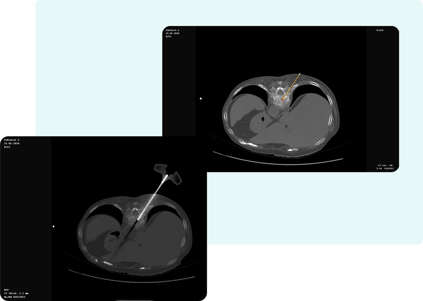 Manage Progress Notes