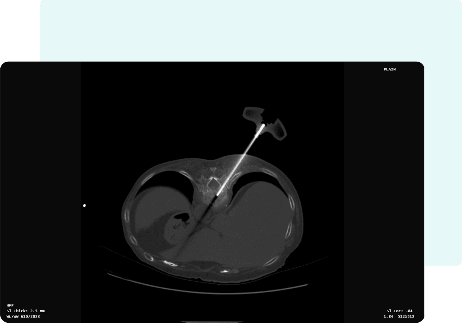 Manage Progress Notes